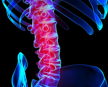 3D illustration of spine with red inflammation, highlighting pain or injury in the neck area.