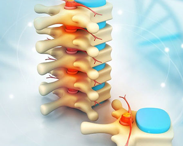 a 3d image of a bone structure with the bones highlighted