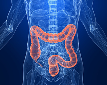 Digital medical illustration of a human colon highlighted within a semi-transparent body.