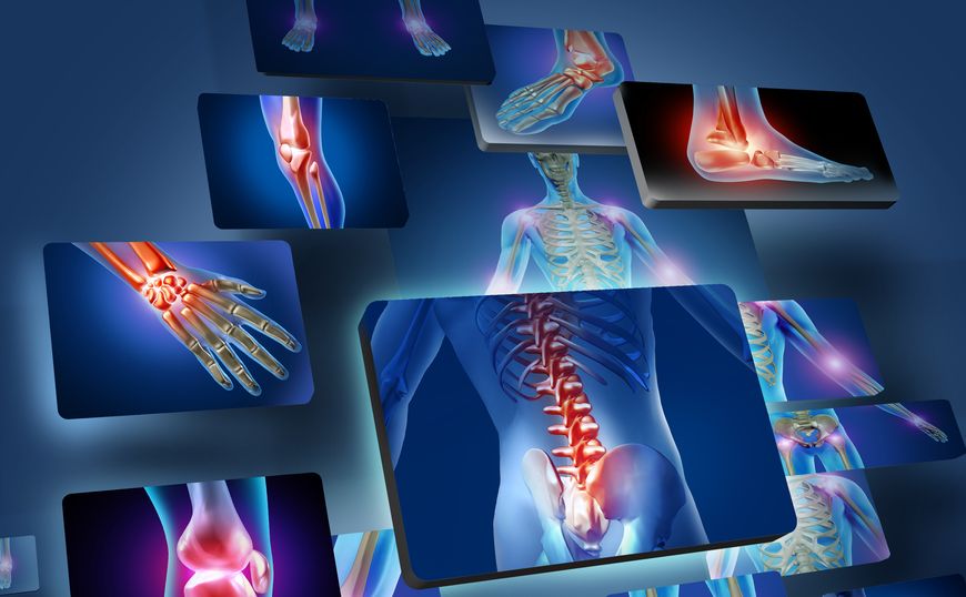 a medical illustration of a human skeleton with bones and bones highlighted