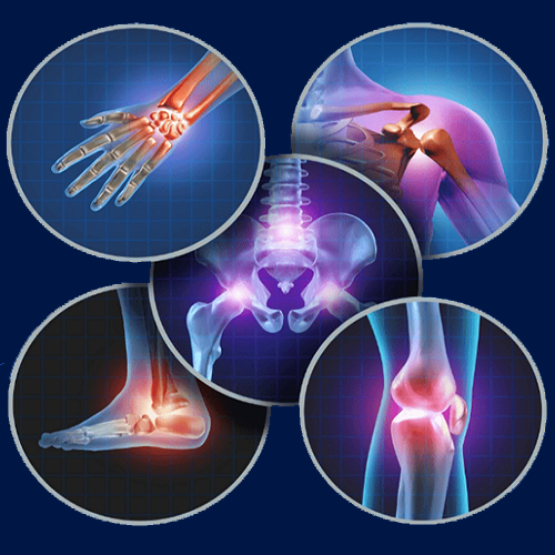 a picture of a medical illustration of a knee joint