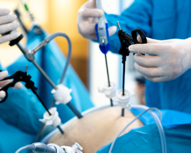 a group of doctors performing surgery on a patient