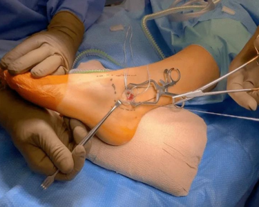 a person is performing surgery on a patient's leg