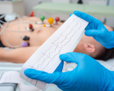 a person in blue gloves holding a piece of ECG paper